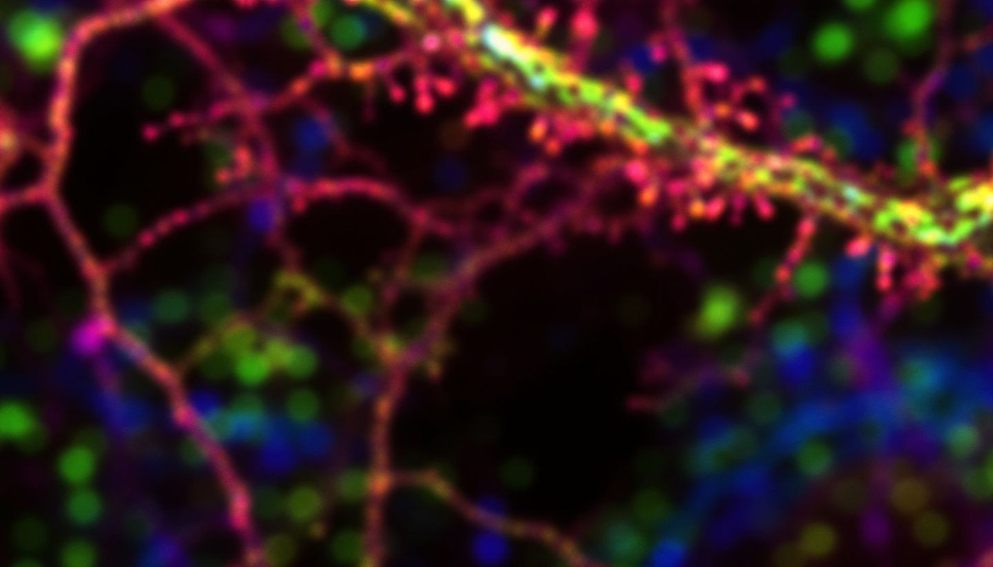 Microbiote et santé mentale explorer les liens entre la flore intestinale et le bien-être psychologique